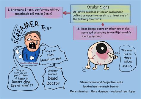 Sjogren Syndrome: Dry Eyes and Dry Mouth - Creative Med Doses