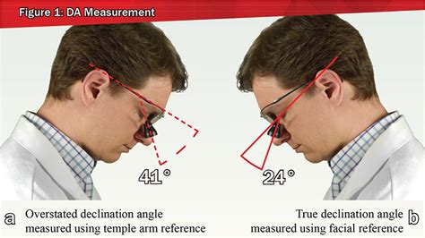 Demystifying Declination Angle - SurgiTel Ergonomic Loupes