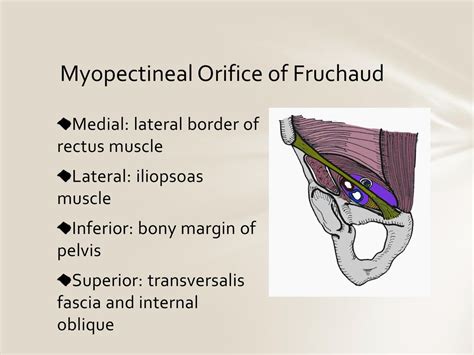 Myopectineal Orifice