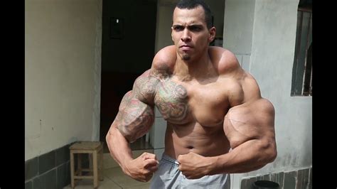 Man nearly loses arms after muscles turn to rock due to toxic ...