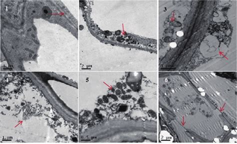 Destructive effects of Rhizoctonia solani phytotoxin on tissue and cell... | Download Scientific ...