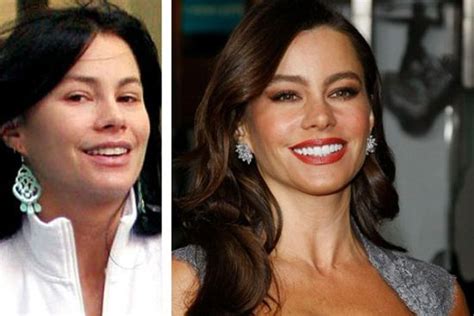 Sofia Vergara Plastic Surgery: Botox, Facials & Rhinoplasty