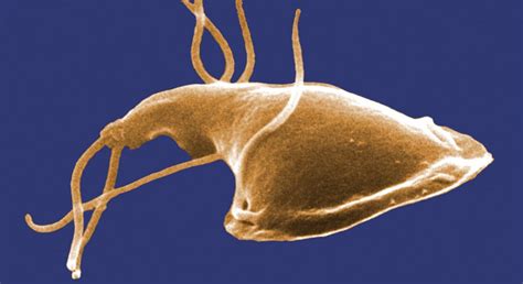 Giardia: Top Symptoms You Need To Know - Byron Herbalist