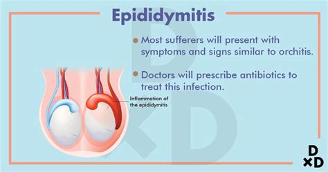 Epididymitis: What Is It, Symptoms, Causes, Diagnosis,, 51% OFF