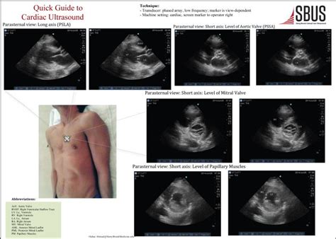 Quick Guide – Cardiac Echo Views