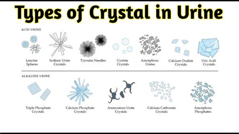 Types of crystals in urine - YouTube