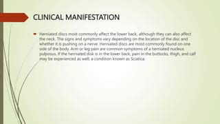 Herniated Nucleus Pulposus (HNP).pptx