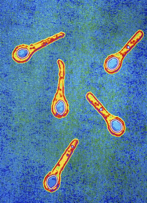 Clostridium Tetani Bacterium Photograph by Pasieka