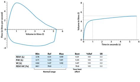 Spirometry: Procedure and All You Must Know | Healthtian