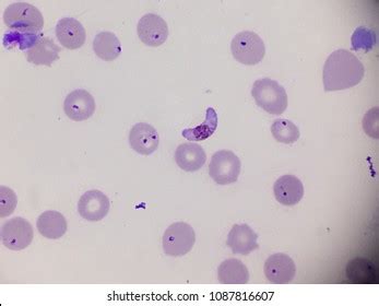 Plasmodium Falciparum Under Microscope