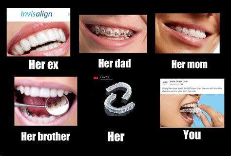 Invisalign Vs Braces Cost Reddit | BRACES POST