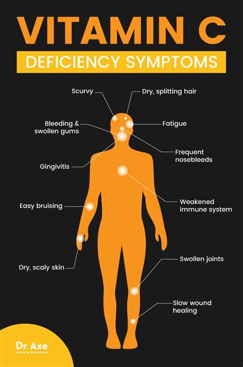 The Most Important Vitamin for Your Health? | Vitamin c deficiency ...