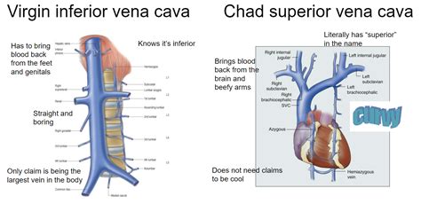 20 Hilarious Inferior vena cava syndrome Puns - Punstoppable 🛑