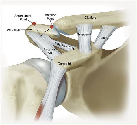 Scapula Fractures - Trauma - Orthobullets