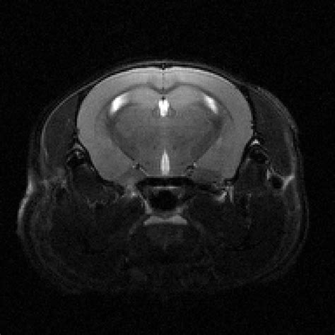 Mouse Brain Anatomical MRI (2D) - CAMRI