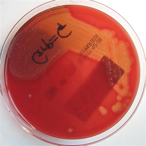 Streptococcus dysgalactiae (Beta haemolytic Streptococcus … | Flickr