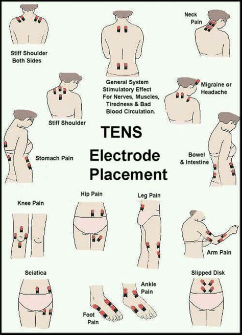 I use a TENS unit myself for ankylosing spondylitis. It really does help some. This chart shows ...