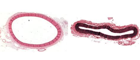 Arteries: Histology | Concise Medical Knowledge