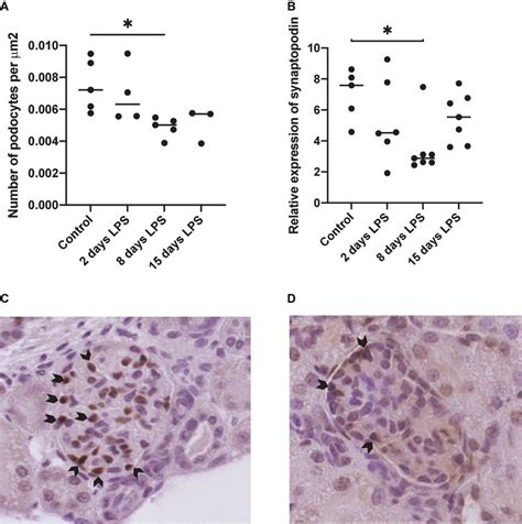 | Expression of podocyte markers wilms tumor 1 (WT1) and synaptopodin ...