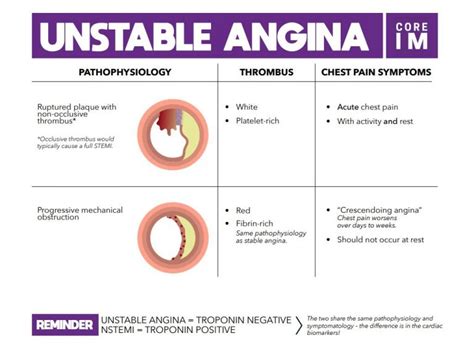 Unstable Angina | Core IM Podcast