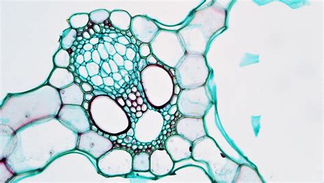 Monocot Stem: Closed Collateral Vascular Bundle in Spargan… | Flickr