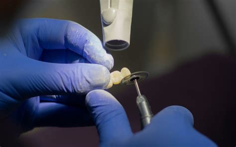 What Are Zirconia Implants: Pros, Cons and the In-Between