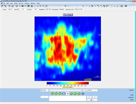 Wheal and Flare Response (WFR) | Laser Speckle | Moor Instruments