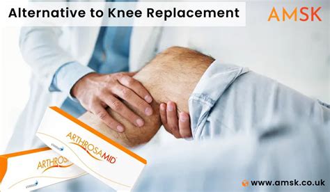 Best Alternative To Knee Replacement | Knee Injection | AMSK