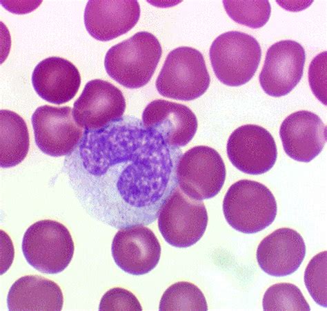 Monocyte; Aisha Barre