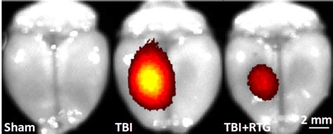 Side-by-side No TBI - TBI - Treated TBI - UT Health San Antonio