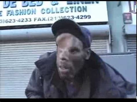 Messed-up guy has face caved in from 3 shot gun blasts to the face.flv - YouTube