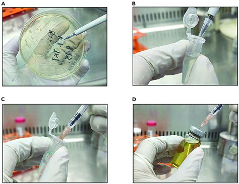 Bacterial inoculation process (A) Pick a single colony from the ...