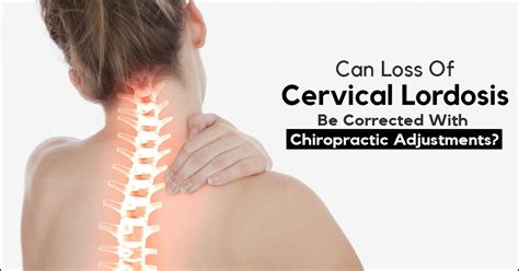 Loss Of Cervical Lordosis Due To Muscle Spasm