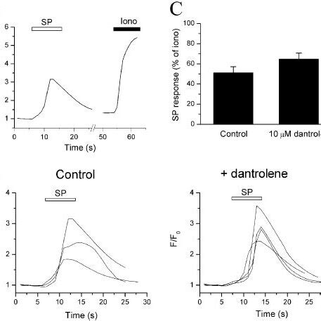 Interruption of the mouse RyR1 gene. (A) Schematic representation of ...