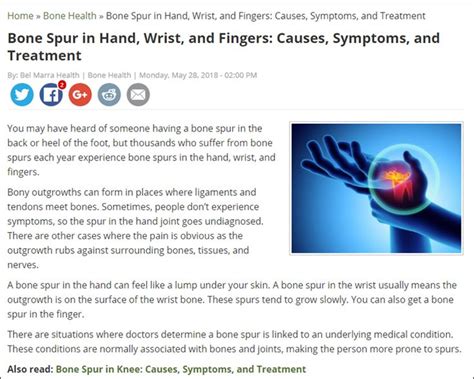 Bone Spur in Hand, Wrist, and Fingers: Causes, Symptoms, and Treatment | Bone spurs, Bones, Wrist