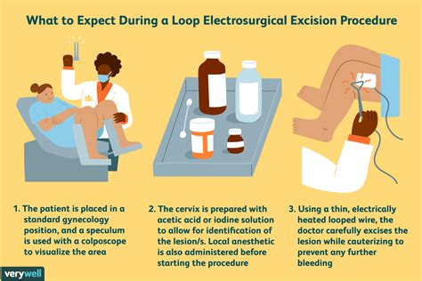 LEEP: Preparation, Recovery, Long-Term Care