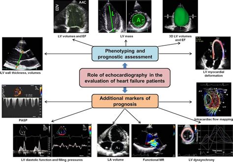 Echocardiogram Heart Failure