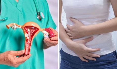 Do YOU have a tilted uterus? The 7 symptoms of a retroverted uterus ...