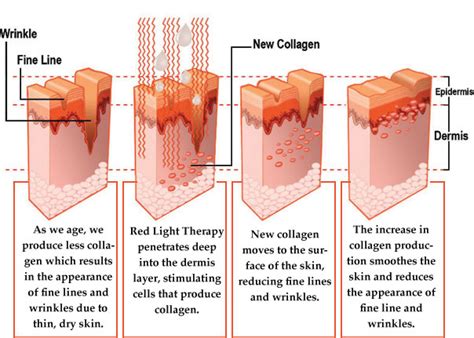 infrared lights therapy - Having Kids