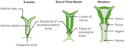 Mullerian Duct Anomalies — Classification and Development