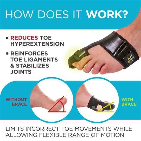 Hallux Limitus Exercises | ces-cl.edu.br