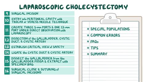 Surgery: Laparoscopic Cholecystectomy - Osmosis