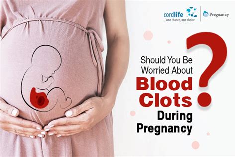 Should You Be Worried About Blood Clots During Pregnancy?