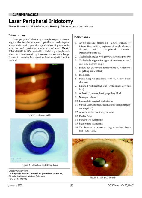 (PDF) Laser Peripheral Iridotomy