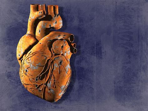 Heart Disease, Conceptual Artwork Photograph by Laguna Design - Fine Art America