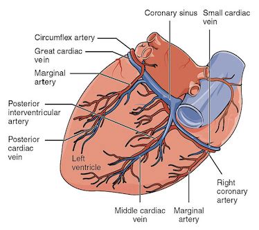 A proximal LAD lesion is a blockage in the left anterior descending ...