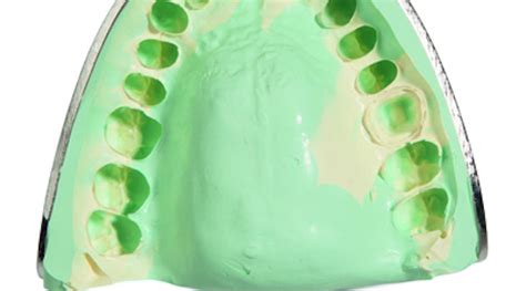 Heraeus Kulzer launches time-saving impression material | Dentistry IQ