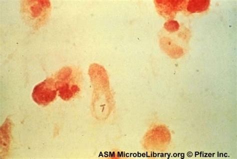 Listeria Gram Stain - Gram Stains