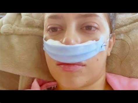 NASAL POLYPS Surgery Update | 5 years later! - YouTube