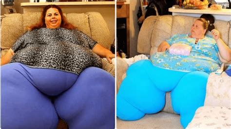 What a bold move! What kind of shape is the 57-year-old lady who dropped 518 pounds in her body ...